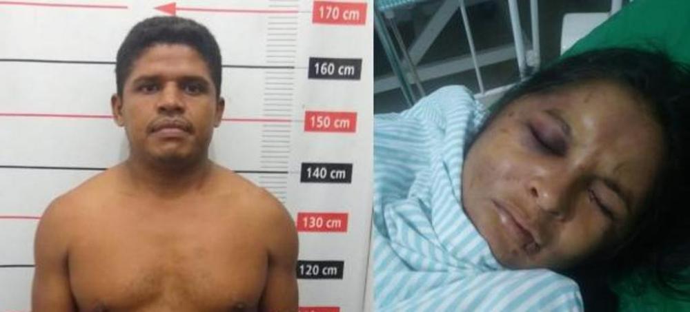 Montagem: Suspeito de agredir a ex-esposa // Vítima das agressões no hospital - Foto: Redação/ Bico do Papagaio