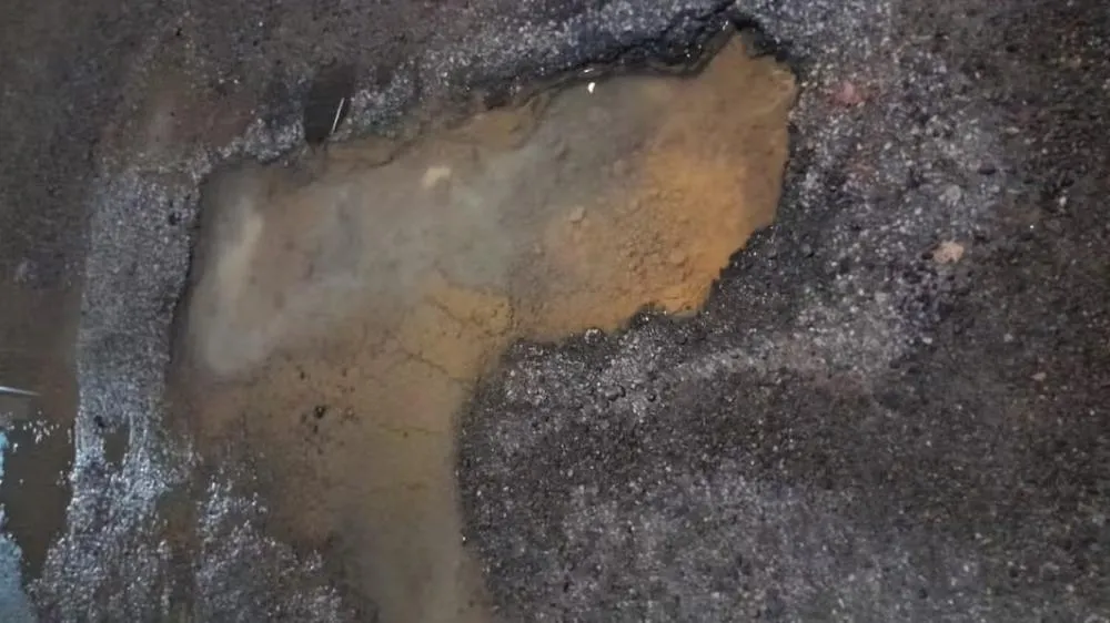 Mulher caiu de moto em buraco e ficou com rosto desfigurado — Foto: Arquivo pessoal